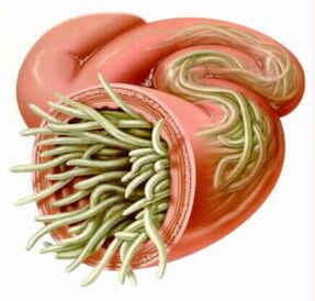 Pasożyty w jelitach