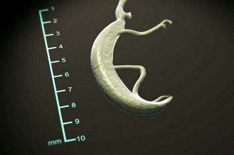 pasożyt z ludzkiego ciała