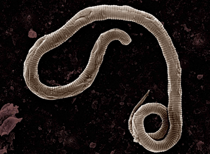 Skąd pochodzą robaki w ludzkim ciele