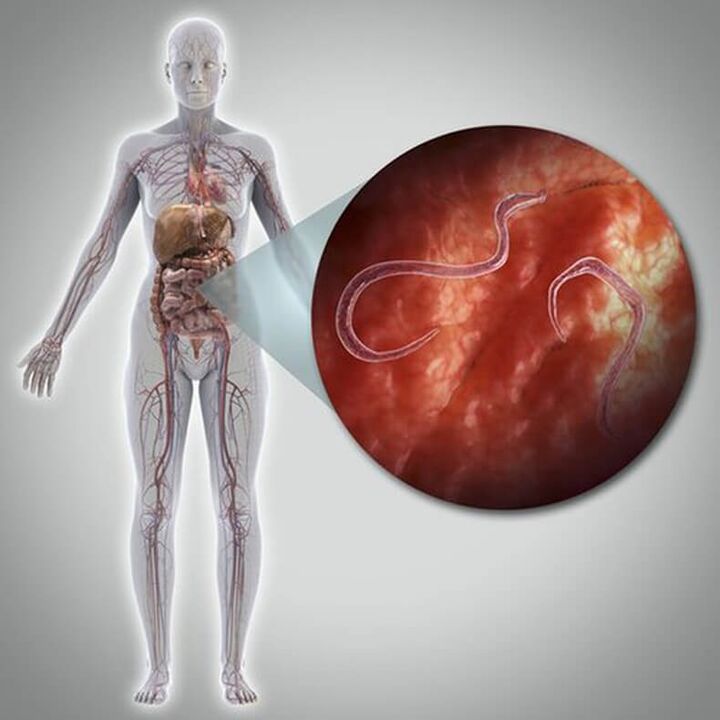 Pasożyty w ciele osoby