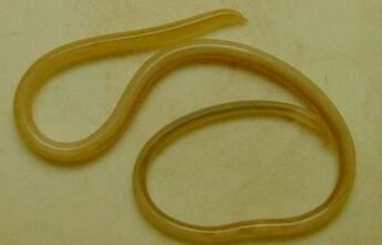 rodzaje pasożytów w organizmie człowieka