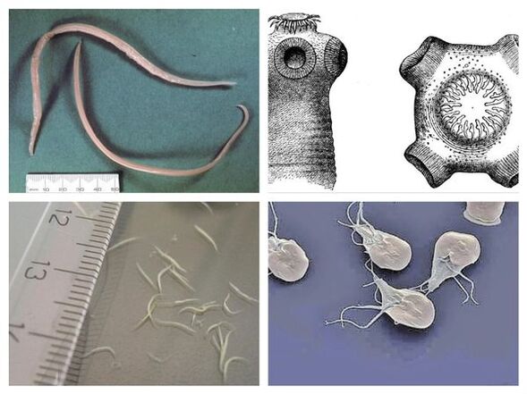Najczęstsze pasożyty człowieka