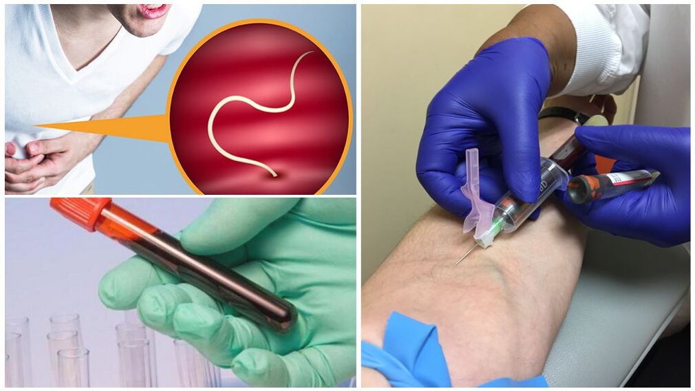 diagnostyka pasożytów