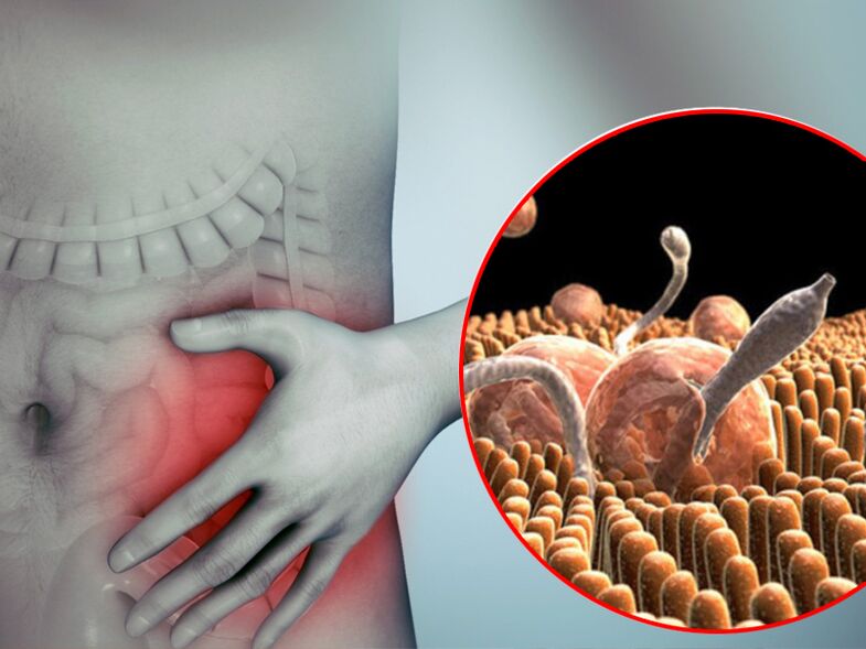 pasożyty w jelicie człowieka